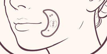 Upright crescent beside the mouth, opening towards the mouth